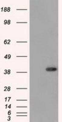 Western Blot: DNTTIP1 Antibody (OTI1F4) [NBP2-02507]