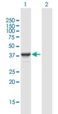 Western Blot: DNTTIP1 Antibody [H00116092-B01P]