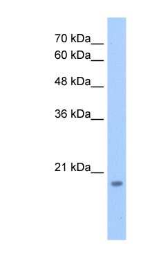 Western Blot: DNTTIP1 Antibody [NBP1-79407]