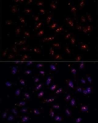 Immunocytochemistry/ Immunofluorescence: DNTTIP2 Antibody - Azide and BSA Free [NBP2-92296]