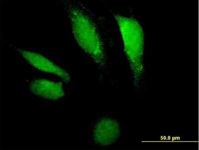 Immunocytochemistry/ Immunofluorescence: DNase II Antibody [H00001777-B01P]