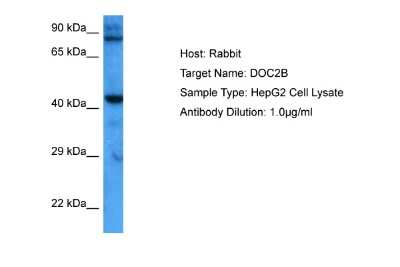 Western Blot: DOC2B Antibody [NBP2-87296]