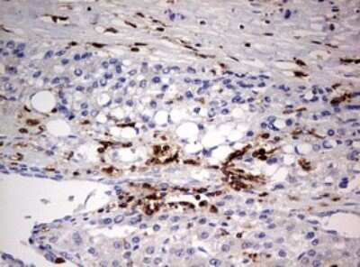 Immunohistochemistry: DOCK2 Antibody (OTI7G2) [NBP2-46468]