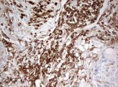 Immunohistochemistry: DOCK2 Antibody (OTI7G2) [NBP2-46468]
