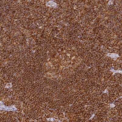 Immunohistochemistry-Paraffin: DOCK2 Antibody [NBP2-38303]