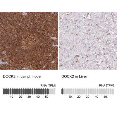 Immunohistochemistry-Paraffin: DOCK2 Antibody [NBP2-38303]