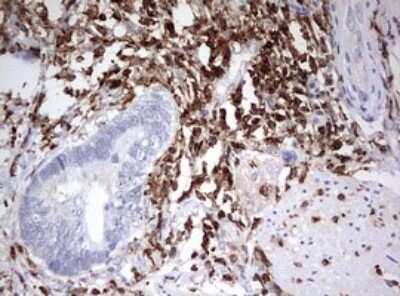 Immunohistochemistry: DOCK2 Antibody (OTI7G2) - Azide and BSA Free [NBP2-70583]
