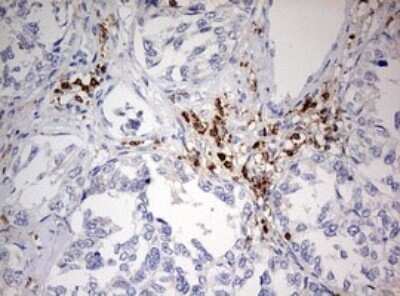 Immunohistochemistry: DOCK2 Antibody (OTI7G2) - Azide and BSA Free [NBP2-70583]