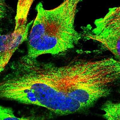 Immunocytochemistry/ Immunofluorescence: DOCK3 Antibody [NBP1-93647]
