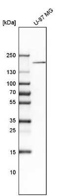 Western Blot: DOCK3 Antibody [NBP1-93647]