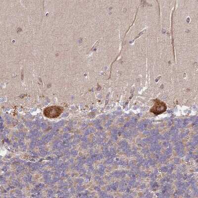 Immunohistochemistry-Paraffin: DOCK9 Antibody [NBP2-38517]