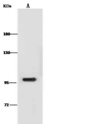 Western Blot: DOG1/TMEM16A Antibody (006) [NBP2-89358]