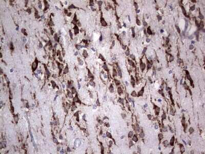 Immunohistochemistry: DOG1/TMEM16A Antibody (OTI1C8) [NBP2-46527]