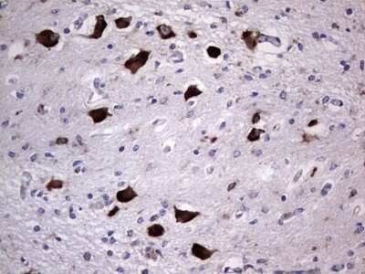 Immunohistochemistry: DOG1/TMEM16A Antibody (OTI1C8) [NBP2-46527]
