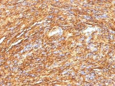 Immunohistochemistry-Paraffin: DOG1/TMEM16A Antibody (DG1/1484) [NBP2-53157]