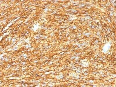 Immunohistochemistry-Paraffin: DOG1/TMEM16A Antibody (DG1/1485) [NBP2-53162]