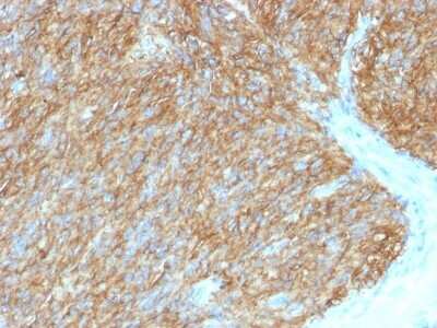 Immunohistochemistry-Paraffin: DOG1/TMEM16A Antibody (DG1/1486) [NBP2-53163]