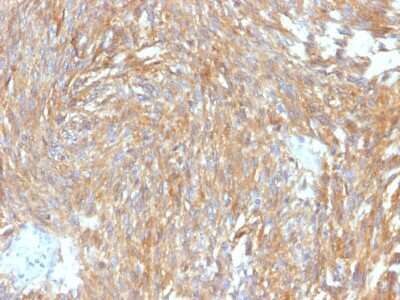 Immunohistochemistry-Paraffin: DOG1/TMEM16A Antibody (DG1/2564R) [NBP3-07652]