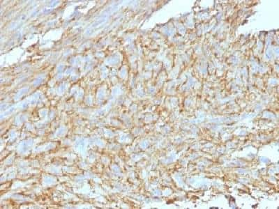 Immunohistochemistry-Paraffin: DOG1/TMEM16A Antibody (DG1/447 + DOG-1.1) [NBP2-34285]