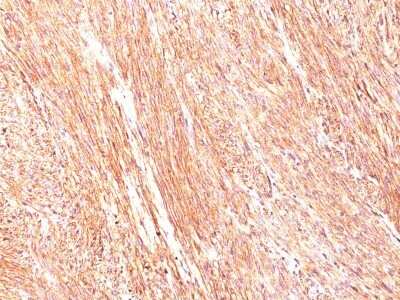 Immunohistochemistry-Paraffin: DOG1/TMEM16A Antibody (DG1/447) [NBP2-44378]