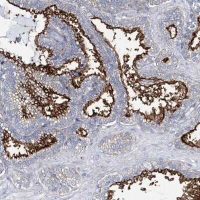 Immunohistochemistry-Paraffin: DOG1/TMEM16A Antibody [NBP2-14296]