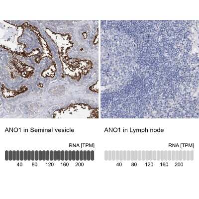 Immunohistochemistry-Paraffin: DOG1/TMEM16A Antibody [NBP2-14296]