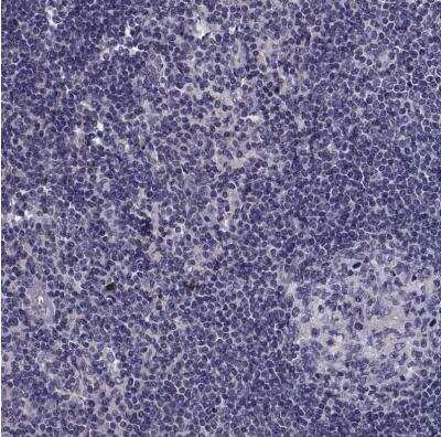 Immunohistochemistry-Paraffin: DOG1/TMEM16A Antibody [NBP2-76552]