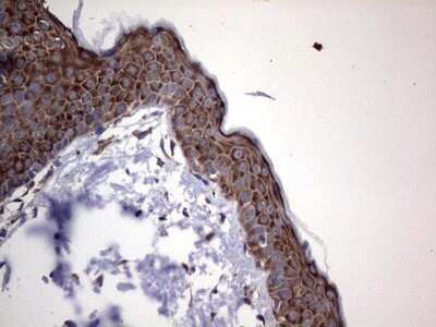 Immunohistochemistry: DOG1/TMEM16A Antibody (OTI1C8) - Azide and BSA Free [NBP2-71987]