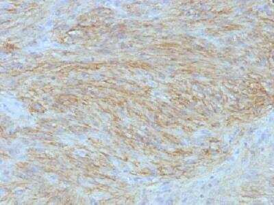 Immunohistochemistry-Paraffin: DOG1/TMEM16A Antibody (SPM580) [NBP2-32841]