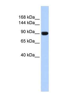 Western Blot: DOG1/TMEM16A Antibody [NBP1-60076]
