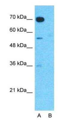 Western Blot: DOG1/TMEM16A Antibody [NBP1-60076]