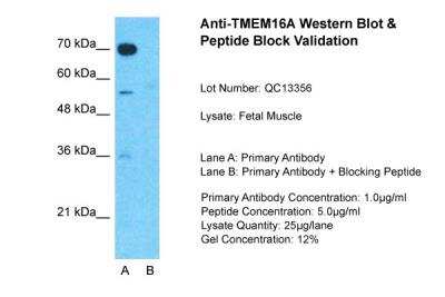 Western Blot: DOG1/TMEM16A Antibody [NBP1-60076]