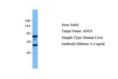 Western Blot: DOG1/TMEM16A Antibody [NBP1-60076]