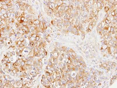 Immunohistochemistry-Paraffin: DOK1 Antibody [NBP2-16210]