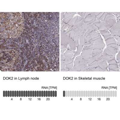 Immunohistochemistry-Paraffin: DOK2 Antibody [NBP2-62652]