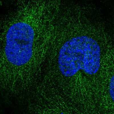Immunocytochemistry/ Immunofluorescence: DOK4 Antibody [NBP2-33274]