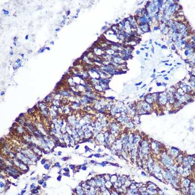 Immunohistochemistry-Paraffin: DOK4 Antibody - Azide and BSA Free [NBP2-92597]