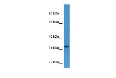 Western Blot: DOK4 Antibody [NBP2-82902]