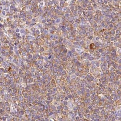 Immunohistochemistry: DOK6 Antibody [NBP2-32609]