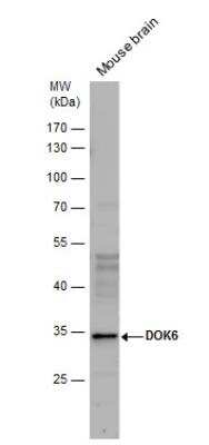 Western Blot: DOK6 Antibody [NBP2-16211]