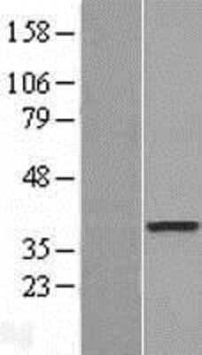 Western Blot: DOK6 Overexpression Lysate [NBL1-09981]