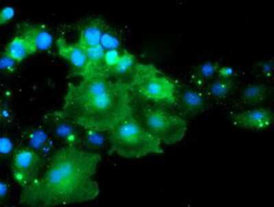 Immunocytochemistry/ Immunofluorescence: DOK7 Antibody (OTI1A9) [NBP2-02073]