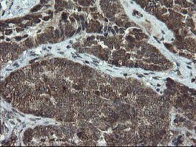 Immunohistochemistry-Paraffin: DOK7 Antibody (OTI1A9) [NBP2-02073]