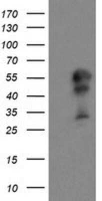 Western Blot: DOK7 Antibody (OTI1A9) [NBP2-02073]