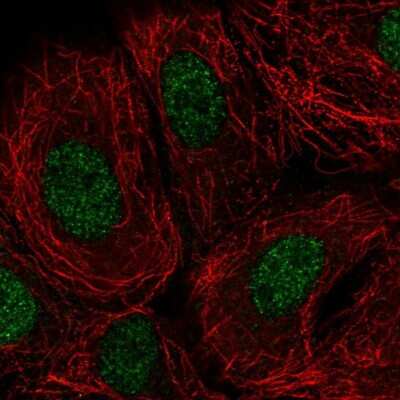 Immunocytochemistry/ Immunofluorescence: DOK7 Antibody [NBP2-32465]