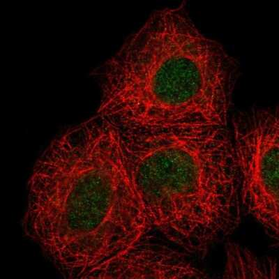 Immunocytochemistry/ Immunofluorescence: DOK7 Antibody [NBP2-68794]