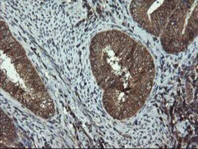 Immunohistochemistry: DOK7 Antibody (OTI1A9) - Azide and BSA Free [NBP2-72494]