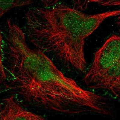 Immunocytochemistry/ Immunofluorescence: DONSON Antibody [NBP2-38599]