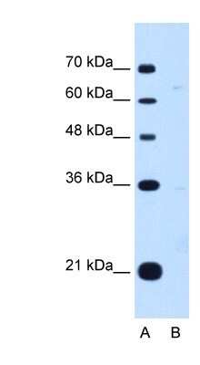 Western Blot: DONSON Antibody [NBP1-70752]