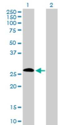 Western Blot: IGSF6/DORA Antibody [H00010261-D01P]